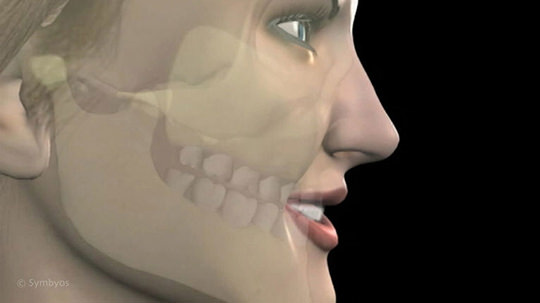 Created by Symbyos Dental animation still